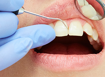 町屋メディウム歯科　予防歯科の重要性