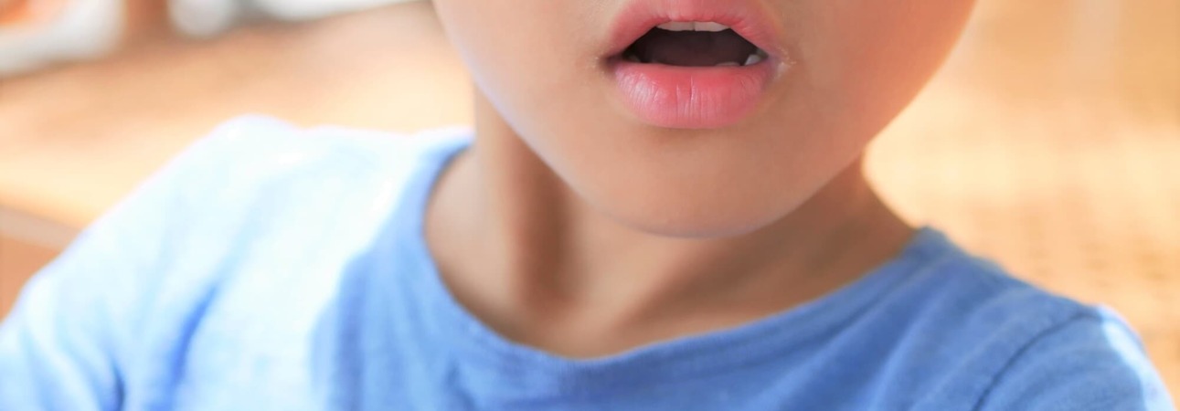口呼吸の子どもの口元