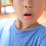 口呼吸の子どもの口元