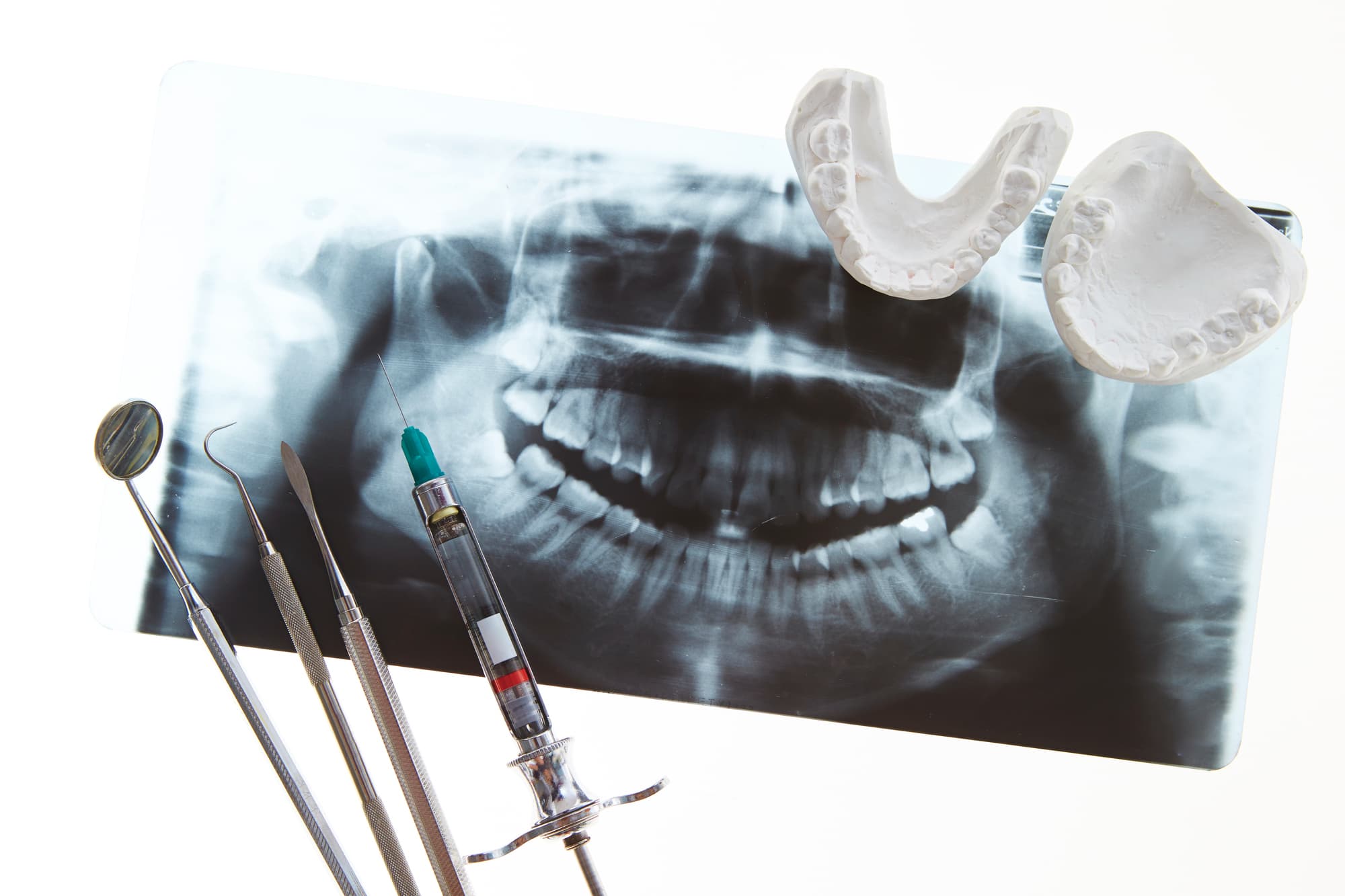 歯のレントゲン写真と麻酔などの歯科器材