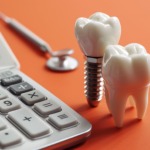 インプラント治療にかかる費用のイメージ