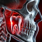 骸骨の親知らずをクローズアップしているイメージ